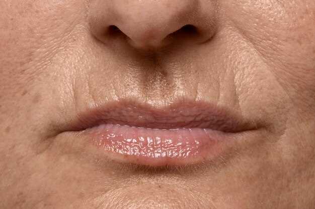 Plan for Promoting Amoxicillin for Swollen Lips Treatment